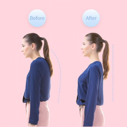 Smart Posture Corrector™